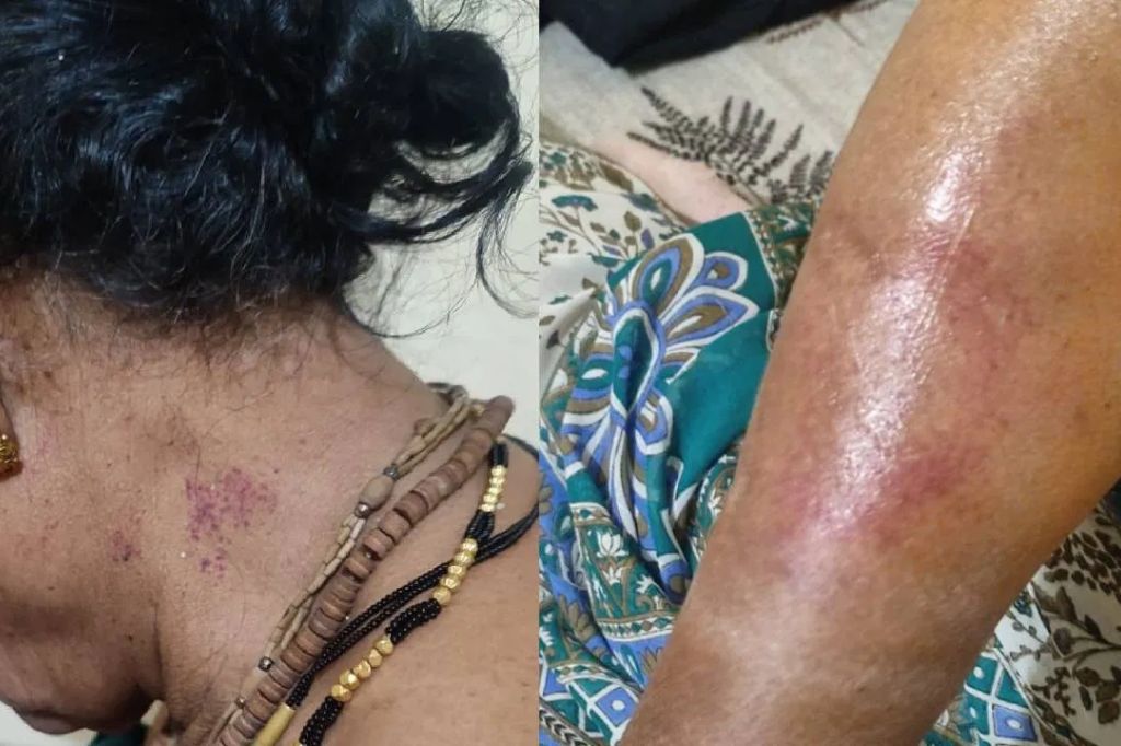 उपमुख्यमंत्री अजित पवारांच्या पदाधिकाऱ्याने जन्मदात्या आईलाच केली मारहाण, महिलेने समोर येत कथन केली आपबिती