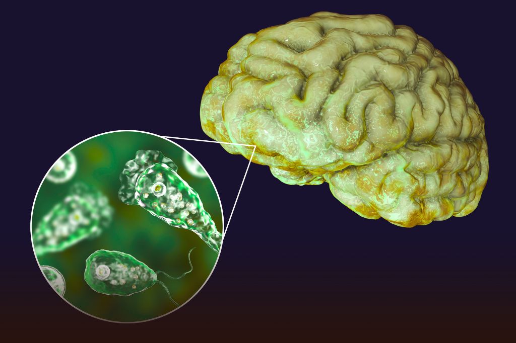केरळमध्ये मेंदू खाणाऱ्या परजीवीचा कहर! आतापर्यंत 17 जणांचा मृत्यू