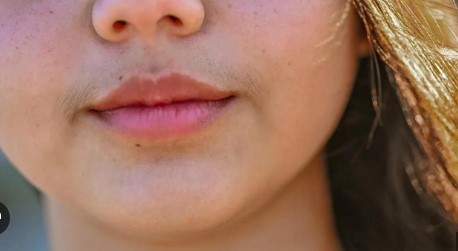फक्त मुलांनाच नाहीतर मुलींनाही येत आहेत दाढी-मिशा; तज्ज्ञांनी नेमकं काय म्हटलं?