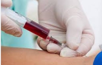 ब्लड टेस्टशिवाय फॅटी लिव्हर येईल ओळखता; ‘या’ सोप्या पद्धती वापरून पाहाच…