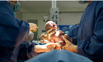 नॉर्मल डिलिव्हरीपेक्षा C-Section चे वाढतंय प्रमाण; आई होण्यासाठी महिलांचं प्राधान्य…