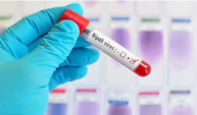 निपाह व्हायरसचा वाढतोय पुन्हा धोका; काय घ्यावी नेमकी काळजी, घ्या जाणून…