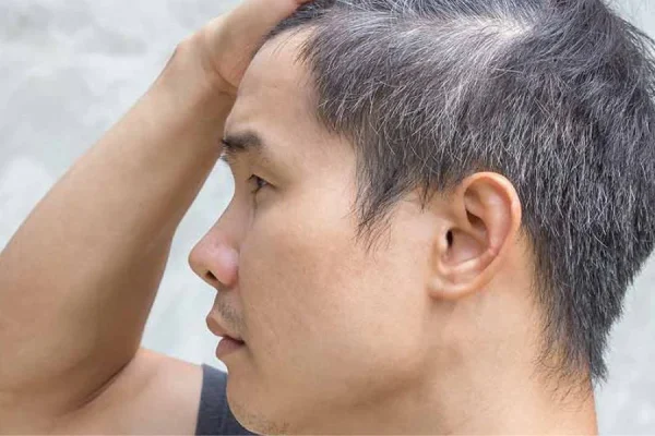 लहान वयातच केस पांढरे होत आहेत? ‘ही’ असू शकतात त्यामागची कारणे…