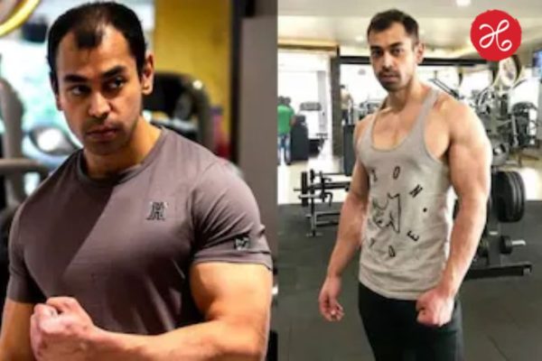Prateek Yadav Death: मोठी बातमी! मुलायम सिंह यादव यांचे धाकटे चिरंजीव प्रतीक यादव यांचे 38 व्या वर्षी निधन